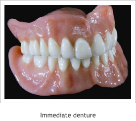 immediate dentures